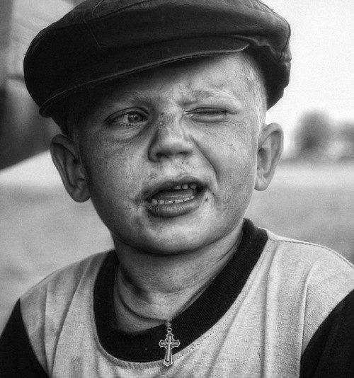 Мишаня Колобанов | Тверь