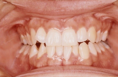 Барри Оаш | Москва