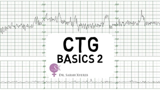 CTG Basics Part 2 - Decelerations & Fetal Physiology