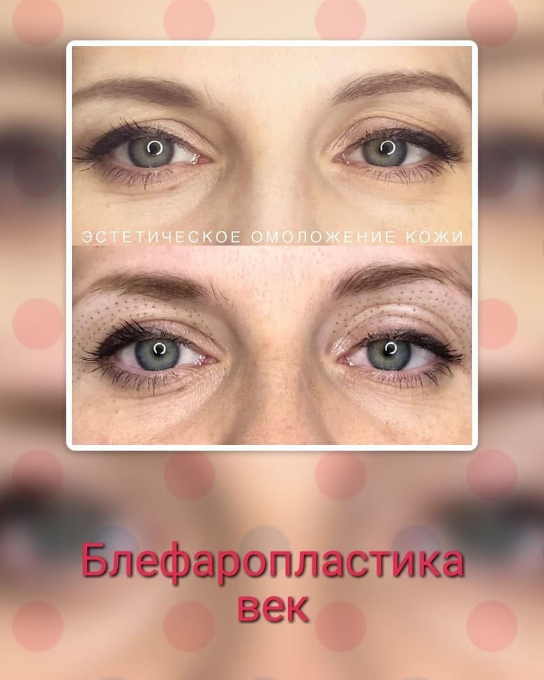 Юлия Шумилова | Дзержинск