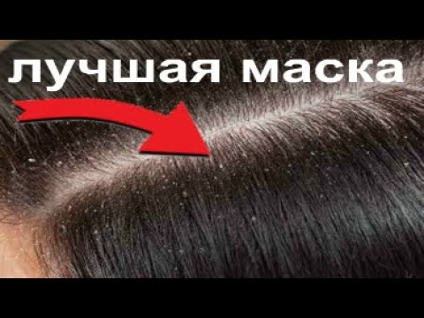 Избавление от перхоти навсегда. Как избавиться от перхоти навсегда. Избавиться от перхоти. Лечебный шампунь. Методы избавления от перхоти.